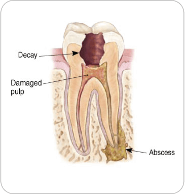 Endodontic Procedure: Examination